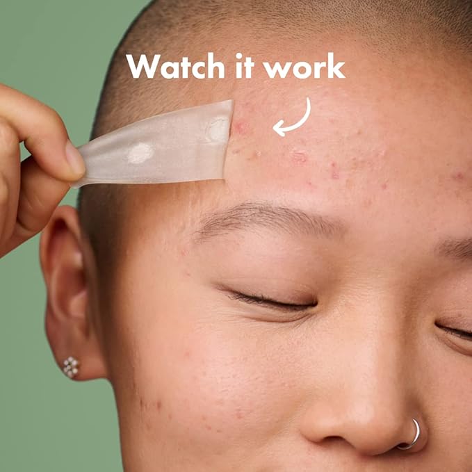 Mighty Patch Surface Large Pimple Patches for Face from Hero Cosmetics, Acne Spot for Body, Cheek, Forehead, and Chin, Pimple Stickers, Hydrocolloid Covers, Vegan-friendly, 10 Count-Velvo Beauty