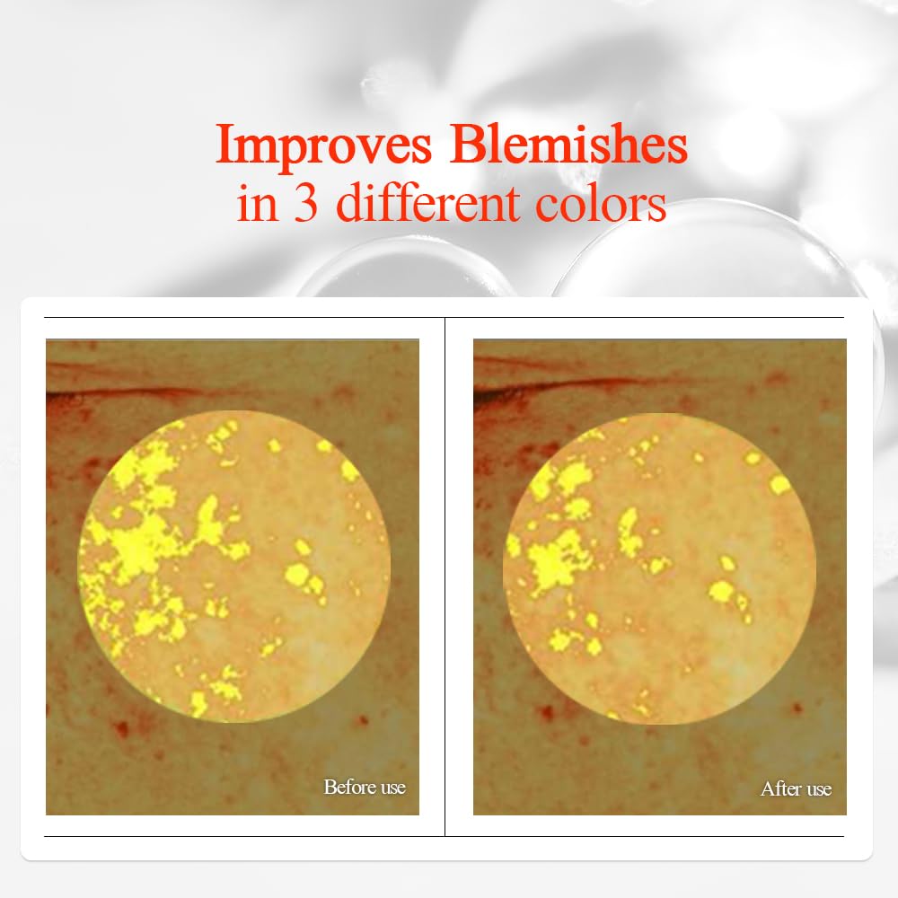 Pyunkang Yul PKY Radiance Vita Serum, 1 Fluid Ounce – Hydrating Serum for Dry Skin with Hyaluronic Acid, Niacinamide, Panthenol, Pearl Extract, 24-Hour Moisturizing and Elasticity Care, EWG Green-Velvo Beauty