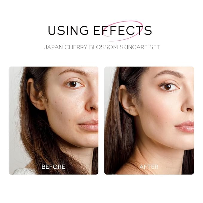 Greyghost Skin Care Set for Teenage Girls Women, 5 Pcs Cherry Blossom Skincare Set - Cleanser, Toner, Serum, Eye cream, Cream, Gentle Skin Cleaning & Care Gift Set, Travel Size Skin Care Set-Velvo Beauty