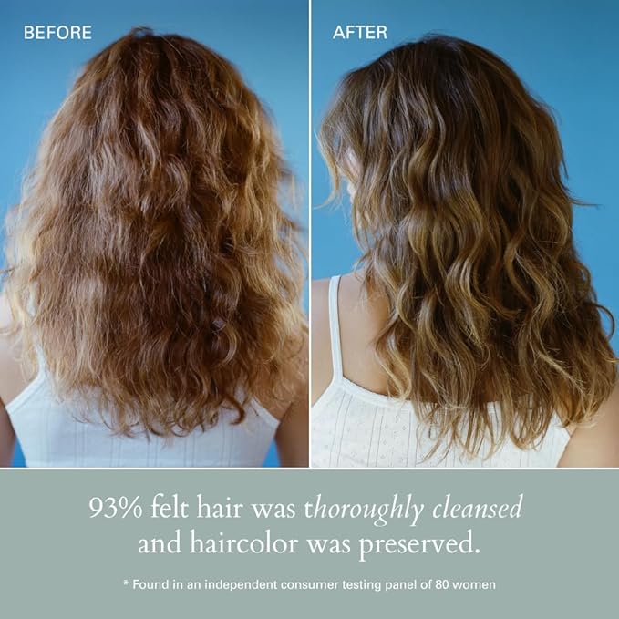 RŌZ Foundation Shampoo For All Hair Types & Textures | Hydrating, Balancing & Cleansing For Healthy Hair| Vegan, Color-Safe, Free of Silicone, Paraben, SLS | Strengthens & Nourishes 10.1 oz/300 mL-Velvo Beauty