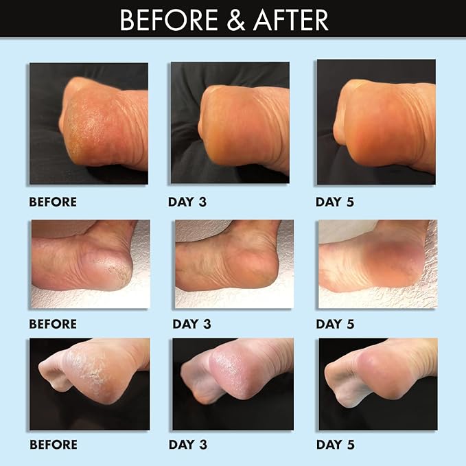 Whish Coconut Milk + Verbena Exfoliating Foot Mask - Smoothes & Softens, Intense Hydration-Velvo Beauty