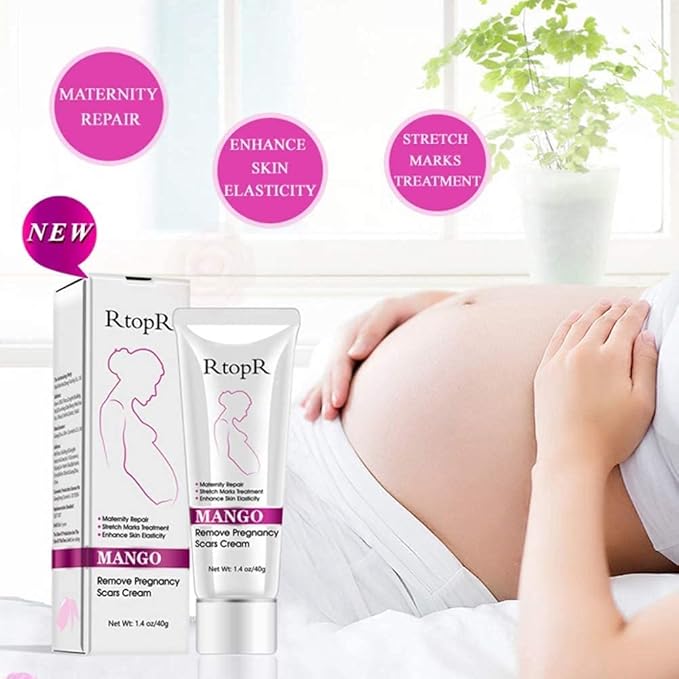 RtopR Mango Stretch Marks and Scar Cream -Stretch Marks and Scar Removal Cream for Pregnancy - Best Body Moisturizer-80g-Velvo Beauty