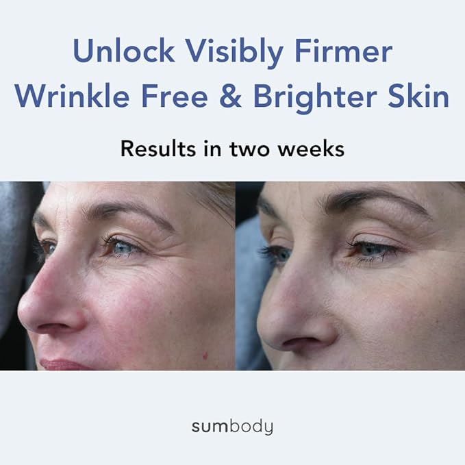 Natural Under Eye Cream Age Defying Plant-Based Retinol Alternative Vegan Eye Repair Moisturizer with Caffeine, antioxidants, Green & white Tea-Prevents Under-eye Wrinkles, Puffiness, Eye Bags-Velvo Beauty