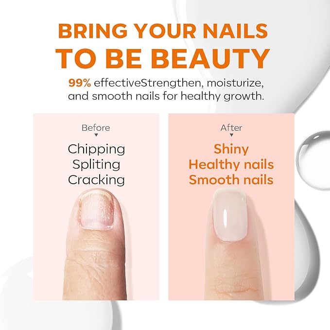 modelones Nail Strengthener, Milky White Nail Polish Natural Nail Concealer Foundation Air Dry Nail Growth Polish for Damaged Nails Imperfection Masking Gifts for Women 15ml-Velvo Beauty