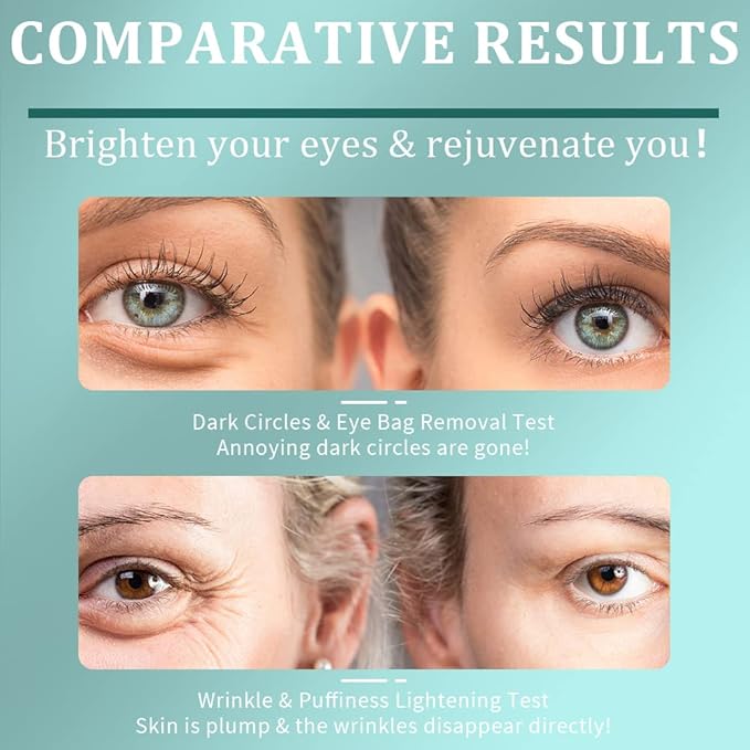 Under Eye Patches, Green Tea Under Collagen Eye Masks for Dark Circles Puffiness Eye Bag Wrinkles, Under Eye Treatment for Men Women, Anti-Aging Brightening Under Eye Gel Pads, 30 Pairs-Velvo Beauty