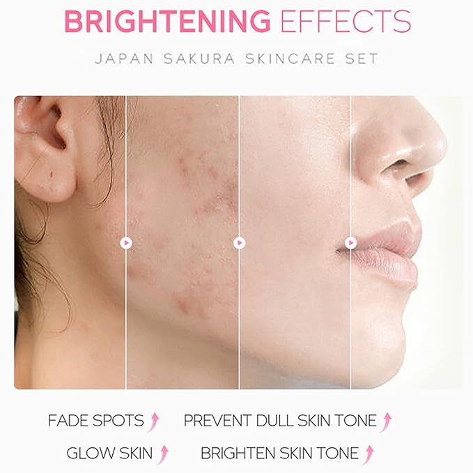 Skin Care Set - Sakura Skin Care Sets & Kits - Women Gift Sets with Cleanser,Serum,Eye Cream,essence Cream - Beauty Products For Women - Skin Care Routine Travel Kit (SetB)-Velvo Beauty