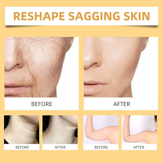 Bee Venom Firming Serum Stick, 2PCS Anti-Aging Face Cream, Lifts and Tightens the Skin, Hydrating, Lifting & Restoring Skin Elasticity, Bee Venom Body Tightening Cream for Women & Men-Velvo Beauty