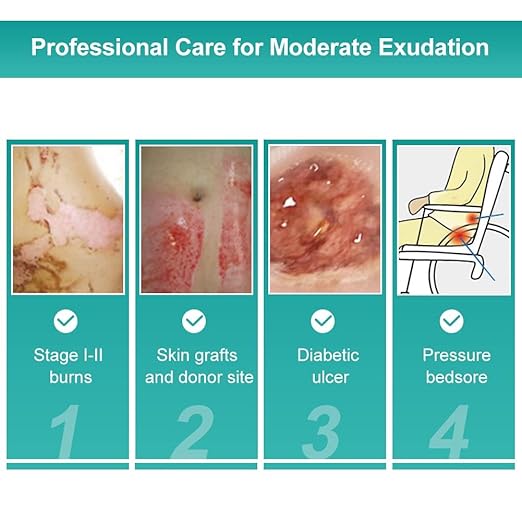 Dimora Hydrocolloid Dressing 4" x 4" for Wound Care, 10 Pack Large Patch Bandages with Self-Adhesive for Bedsore, Burn, Blister, Acne Care, Super Absorbent for Fast Healing-Velvo Beauty