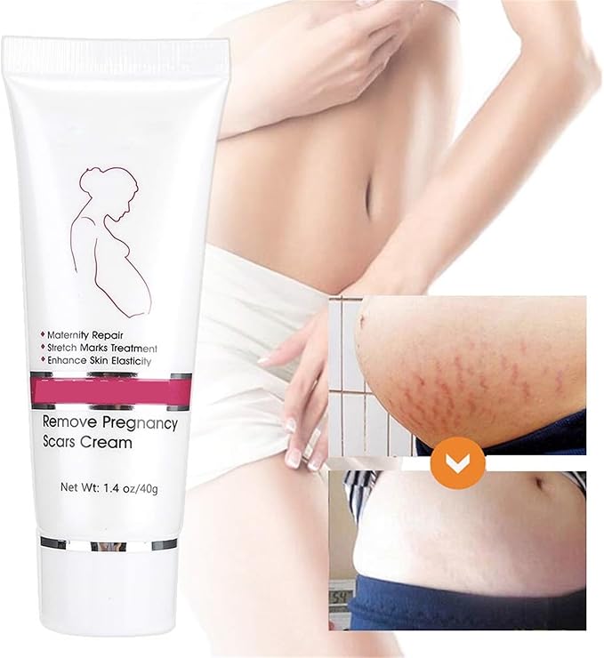 RtopR Stretch Marks and Scar Cream,Crema para Estrias De Embarazo,Stretch Marks Postpartum Repairing Cream Wrinkles Diluting Removal Cream Crema De Cacao para Cicatrices-Velvo Beauty