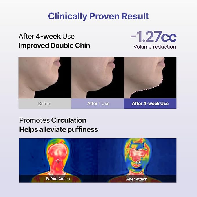 MEDITHERAPY Tension Up Mask 5EA - Korean Collagen Face V Line Lifting Mask - Hydrating Firming & Skin Tightening for Sharp & Sculpted Contour - Matrixyl & Peptide Gel Facial Mask for Youthful Radiance-Velvo Beauty