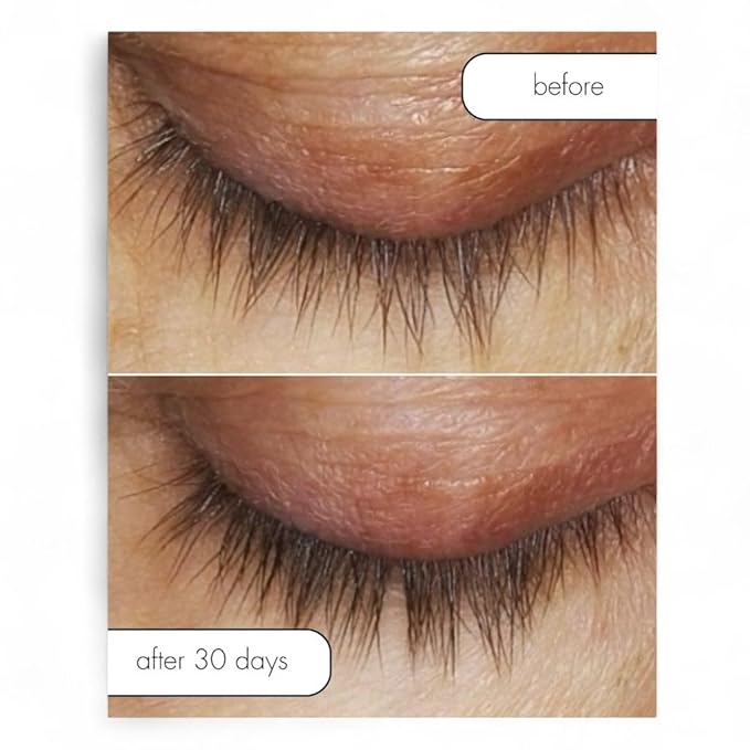 Serious Skincare Lash Bath & Conditioner - Double Action Eye Makeup Remover - Oil Free - Enhancing Peptides Promotes Eyelash Growth - Clover Flower - Effortlessly Removes Waterproof Mascara - 4 oz.-Velvo Beauty