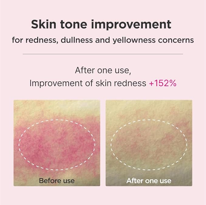 ISOI Blemish Care Up Serum Gift Set, Korean Skin Care for Hydration & Radiance – Full Size or 5-Step Travel Kit Options (5-Step Special Kit (1.77 fl.oz))-Velvo Beauty