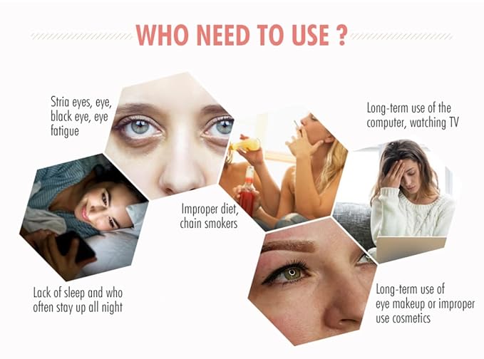 Under Eye Patches (30pcs) - Rose, Gold, hydro-gel Under Eye Mask Amino Acid & Collagen, Under Eye Mask for Face, Dark Circles and Puffiness, Beauty & Personal Care-Velvo Beauty