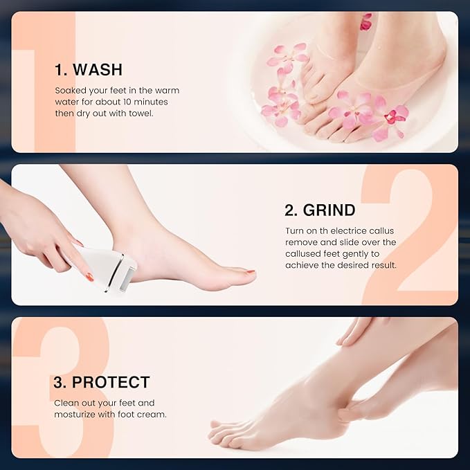 Electric Foot Callus Remover, Rechargeable Portable Electronic Foot File Pedicure Kits, 3 Roller Heads, 3 Speed, Battery Display for Remove Cracked Heels Calluses and Dead Skin-Velvo Beauty