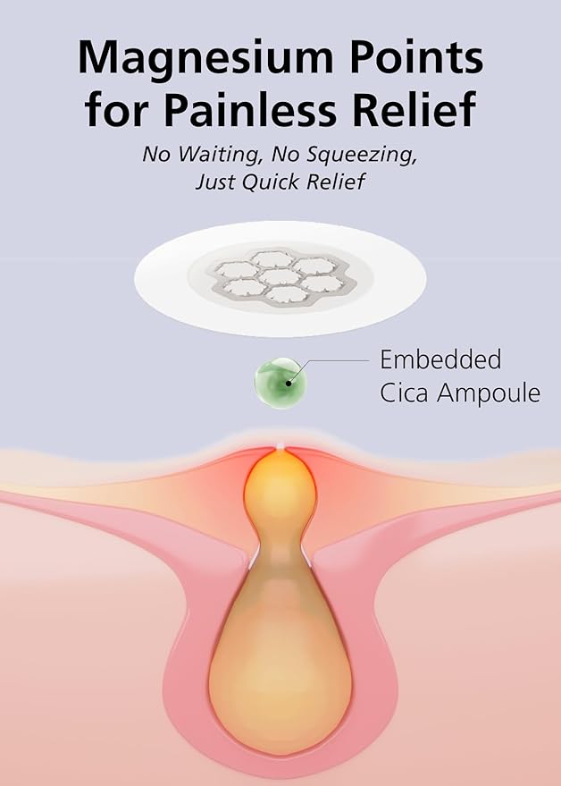 EasyDerm Quick Calming Magnesium Patches – 30 Patches Bulk Pack, Individually Wrapped Acne Care, Includes Tweezers & Ampoule, Korean Skincare, Made by Daewoong Pharmaceutical-Velvo Beauty