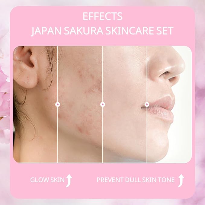 Sakura Skin Care Set, Women Gift Sets, Skin Care Kit with Cleanser, Toner, Serum, Eye Cream, Face Cream, Skin Care Routine Kit for Women, Even Skin Tone, Tighten & Firm Skin-Velvo Beauty