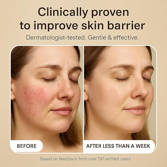 Love Scrub with Hyaluronic Acid Natural Face Exfoliator for Wrinkles, Acne, Fine Lines, Blackheads & Clogged Pores-Velvo Beauty