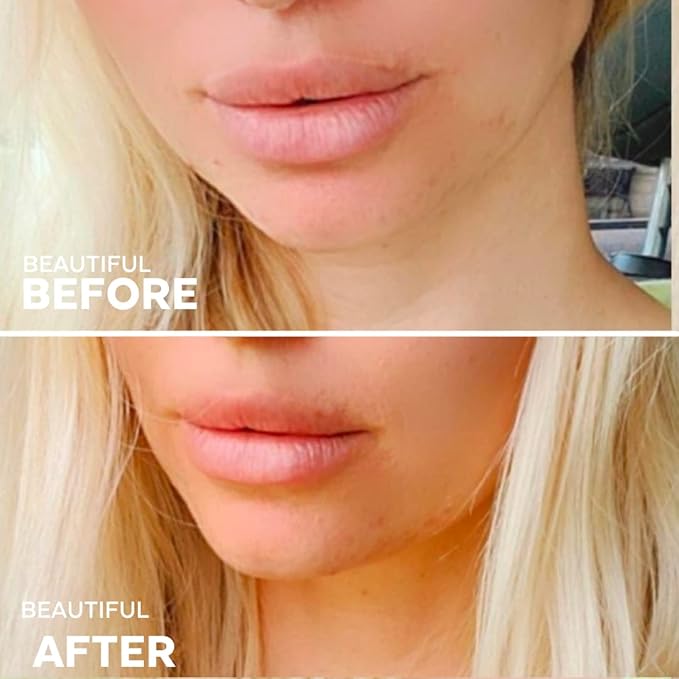 Three Ships Buttercream Hydrating Lip Mask – Intensive Vegan Lip Moisturizer – As Seen on TV – Soothing, Natural Lip Conditioner Treatment for Dry, Damaged Lips, 15g-Velvo Beauty