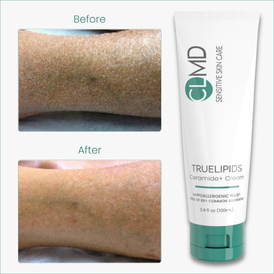 CLMD TrueLipids Ceramide+ Cream – Deep Moisturizing Barrier Support for Sensitive Skin – Hydrates and Soothes – Hypoallergenic, Nourishing, and Dermatologist-Tested – 3.4 fl oz-Velvo Beauty