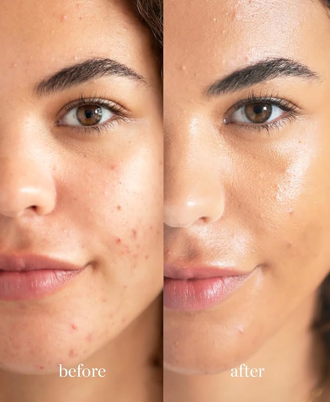 Ere Perez - Natural Lychee Crème Corrector | Vegan, Cruelty-Free, Clean Beauty (Cinco – Golden Pecan, 0.33 oz | 10 ml)-Velvo Beauty