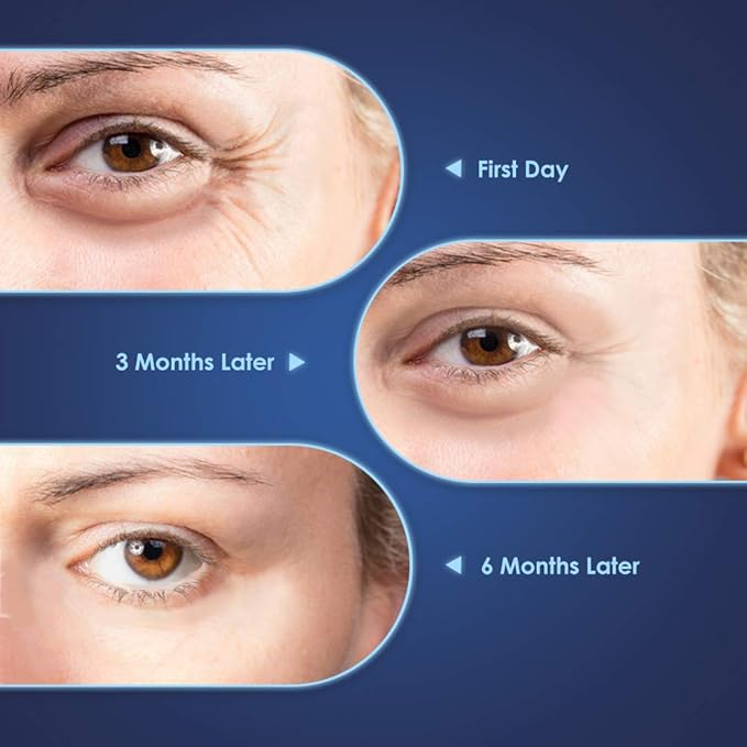 Brightening Vitamin C Eye Gel Cream for Dark Circles & Puffiness, Eye Cream to Help Reduce Fine Lines & Crow's Feet, Boost Hydrating Under Eye Treatment with Hyaluronic Acid & Peptides-Velvo Beauty