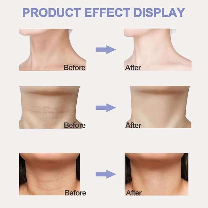 Neck Firming Cream, Neck Tightening Cream, Tighten and Lift Neck Cream, Neck Creams for Tightening and Firming Sagging Skin, Help Reduce Fine Lines & Wrinkles-Velvo Beauty