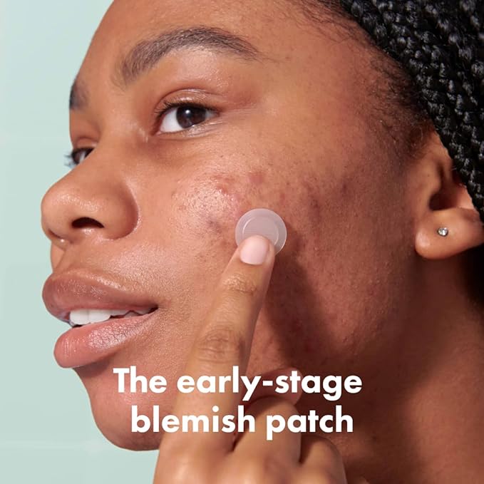 Mighty Patch Micropoint Large Hydrocolloid Pimple Patches for Face Blemishes from Hero Cosmetics, Acne Stickers for Early Stage Zits & Hidden Pimples, 395 Proprietary Micropoints, 8 Count-Velvo Beauty