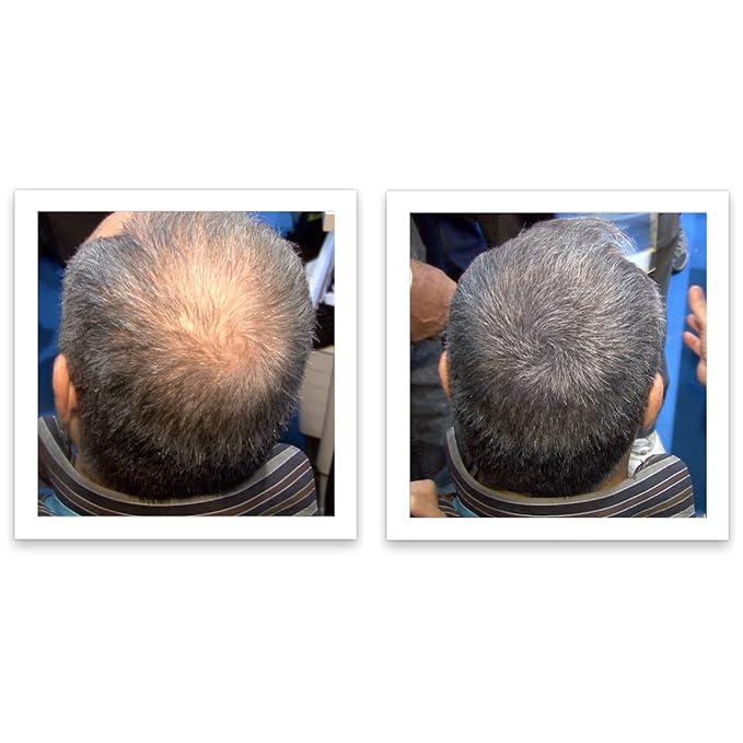 Trial Size - Make Thin Hair Look 10X Fuller. Eliminate Bald Spot and Thinning Hair Instantly. All-Natural Hair Concealer. Salt & Pepper - Light-Velvo Beauty