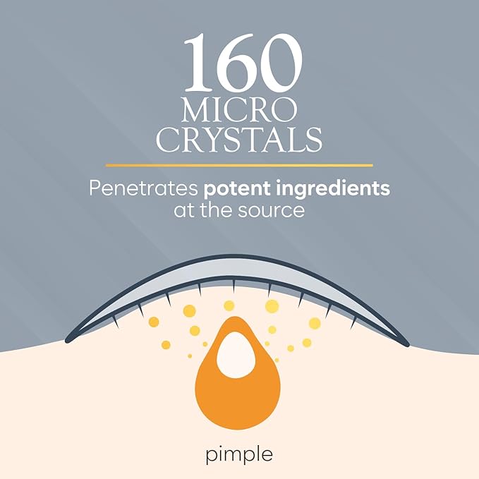 Microdart Acne Patch, Zit Patches for Cystic Acne Overnight Care, Cystic Acne Coverage, Pimple Patches Microdart Technology - Salicylic & Hyaluronic Acid (24 Count)-Velvo Beauty