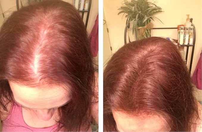 Caboki Sample Size - Get 10X Fuller Hair, Eliminate Bald Spot Instantly. All-Natural, Plant-Based Hair Fibers for Thinning Hair. Light Auburn (red/ginger hair)-Velvo Beauty