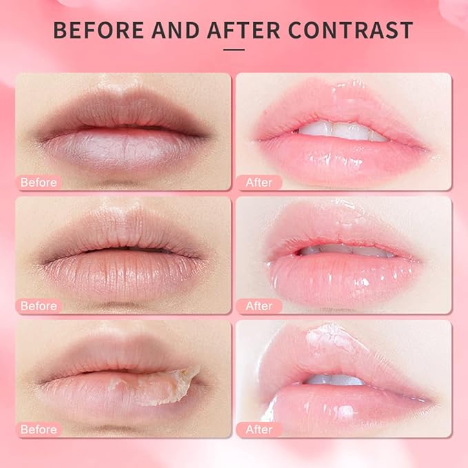 Lip Scrub, Lip Scrubs Exfoliator Moisturizer Dr.YIMAN Sugar Lip Scrub, Lip Exfoliator Scrub for Dry and Chapped Lips,Anti-Aging and Temping, Lip Mask, Lip Care Products, Lip Scrubber, Lip Moisturizer-Velvo Beauty