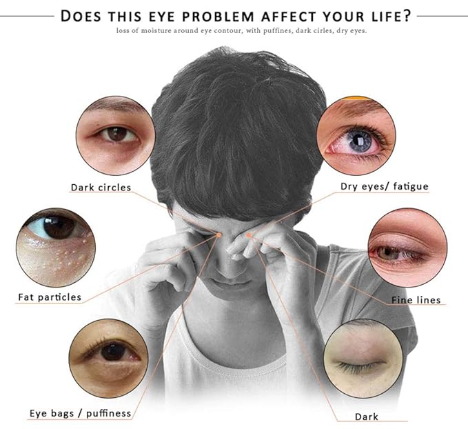 Eye Peptide Serum Eye Massage Roller Nourishing Relieve Loose Eye Bags Dark Circles Eye Skin Care Under Eye Cream for Fine Wrinkles and Puffiness Daily Skincare(Nourishing Grey)-Velvo Beauty