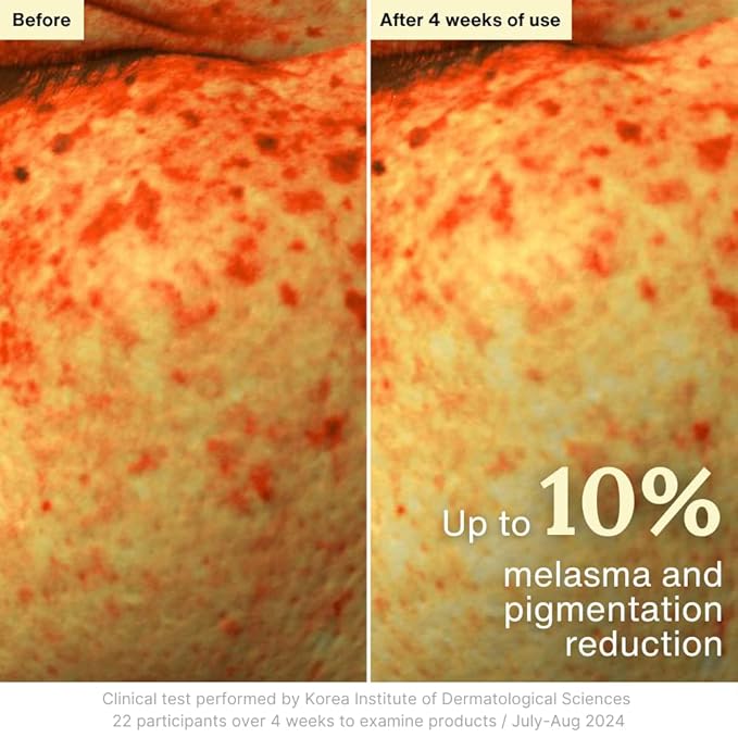 Rothea Resilience Cream, Anti-Aging with Bakuchiol 10,000ppm (Natural Retinol Alternative), Face Moisturizer, Neck Cream with Collagen, Ceramides, Peptides, Niacinamide, Korean Skin Care, 1.7 oz-Velvo Beauty