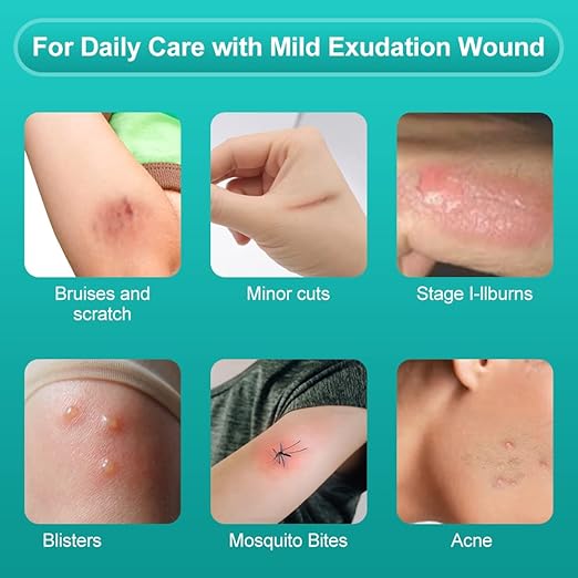 Dimora Hydrocolloid Wound Dressing, 10 Pack Ultra Thin 4" x 4" Large Patch Bandages with Self-Adhesive, Fast Healing for Bedsore, Burn, Blister, Acne Care, Sterile and Waterproof-Velvo Beauty