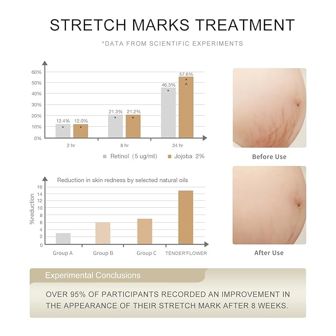 Stretch Mark Oil（110ml）, body oil for Pregnancy,belly oil, belly abdominal Serum Skin Care,Moisturizing Dry Skin, Tender & Softening，True Belly Serum 3.7OZ-Velvo Beauty