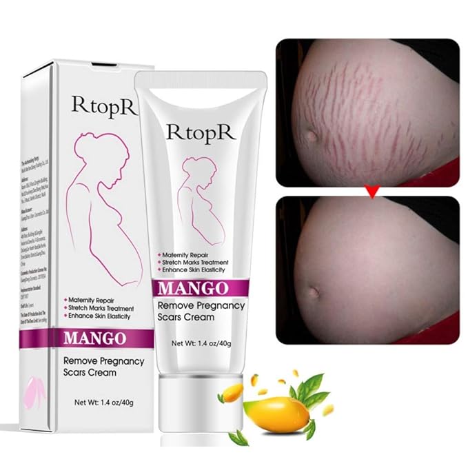 Mango Stretch Marks and Scar Cream, Stretch Marks and Scar Removal Cream for Pregnancy, Stretch Marks Scar Belly Creams for Wrinkles, Obesity Fat Stretch Mark Moisturizing, Remove Marks (40g)-Velvo Beauty