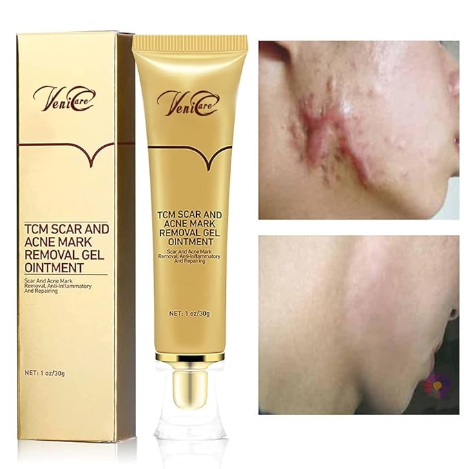 Acne Scar Removal Cream Stretch Marks Face Skin Cream Shrink Pores Gel-Fade Scar Marks Acne Skin Care (Packaging Upgrade) VeniCare-Velvo Beauty