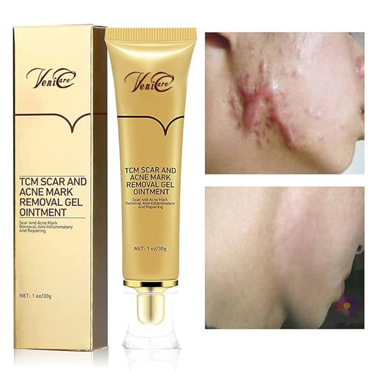 Acne Scar Removal Cream Stretch Marks Face Skin Cream Shrink Pores Gel-Fade Scar Marks Acne Skin Care (Packaging Upgrade) VeniCare-Velvo Beauty