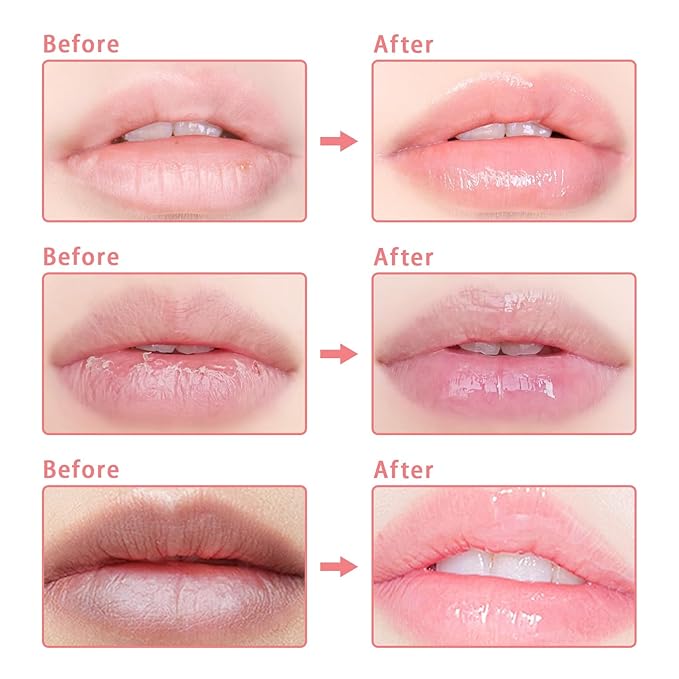 3 Pcs Bee Lip Balm Honey Pot, Coconut Watermelon Apple Lime Lip Mask Overnight, Moisturizing Lip Sleeping Mask, Hydrate Repair Prevent Dry Cracked Lip Exfoliator (Coconut +Watermelon+Apple Lime)-Velvo Beauty