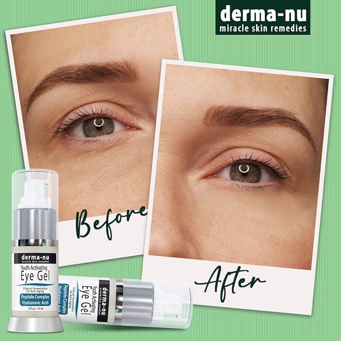 Eye Gel Anti-Aging Cream - Treatment for Dark Circles, Puffiness, Wrinkles and Fine Lines - Hyaluronic Acid Formula Infused Serum with Aloe Vera & Jojoba for Ageless Smooth Skin .5 oz-Velvo Beauty