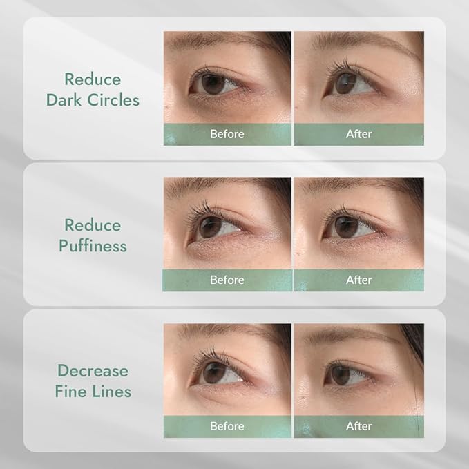 MIZON Cicaluronic Vegan De-puffing Eye Gel Patch, 24K Gold & Cica Under Eye Mask, Reduces Puffy Eyes, Dark Circles and Wrinkles (21 pairs)-Velvo Beauty