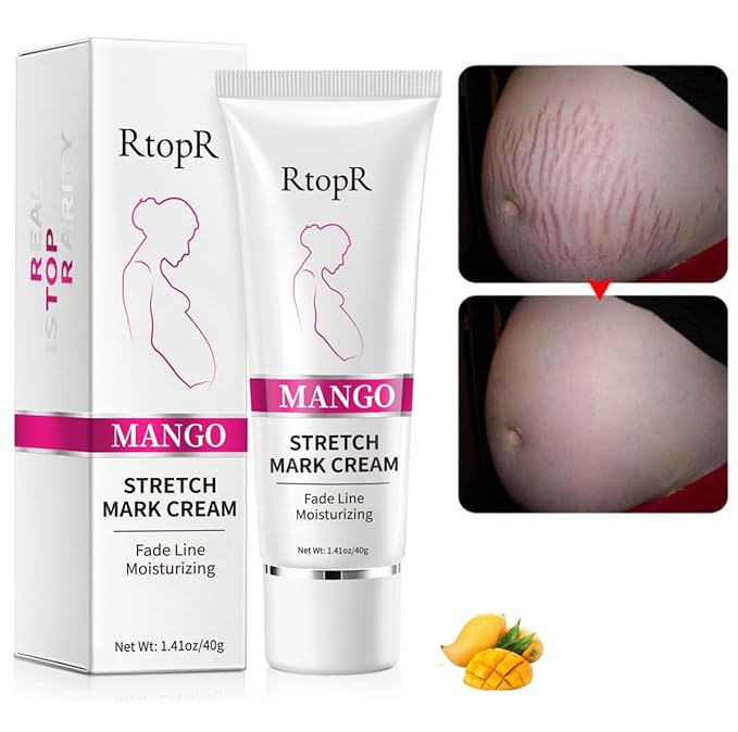 Stretch Mark Removal Cream, Obesity Stretch Mark Moisturizer, Postpartum Repair Stretch Mark Cream, Abdominal Stretch Mark Cream, Remove Marks (1 PCS)-Velvo Beauty