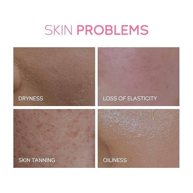 Skin Care, Skin Care Set, Skin Care Kit with Cleanser, Toner, Serum, Eye Cream, Face Cream for Women Teen Girls Mom Daughter Women Beauty Gift Sets 5pcs (Large Capacity Version)-Velvo Beauty