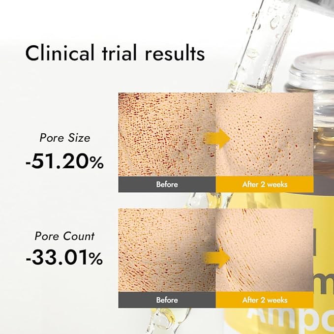 MIZON Real Vitamin C Ampoule, Pure Vitamin C, No Water Added,10 Ingredients, Nutrition, Face Moisturizer (1.01 fl oz)-Velvo Beauty