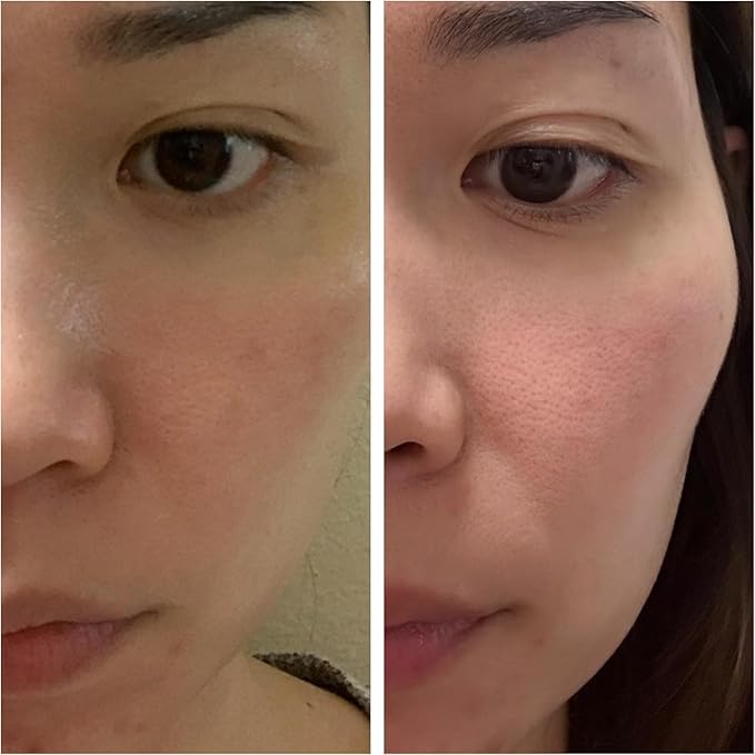 Korean Skin Care Set - Simplified Kbeauty Skincare Kits - Asian Skincare Facial Kit & Sets with Water Based Cleanser, Essence Toner, Under Eye Patches, Face Mask Sheets, Self Care Gifts For Women-Velvo Beauty