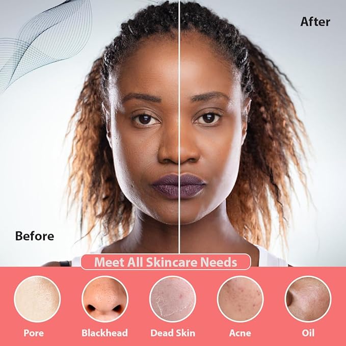 Facial Cleansing Brush | 3-in-1 Electric Face Scrubber | USB Rechargeable Face Cleansing Brush | IPX7 Waterproof | Blackhead Remover | Deep Cleansing & Exfoliating (Pink)-Velvo Beauty