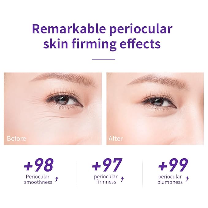 LANBENA Under Eye Cream, Retinol Eye Cream for Dark Circles and Puffiness, Daily Anti-Aging Under Eye Cream with Retinol & Hyaluronic Acid to Fight Fine Lines and Firm Skin (0.68 FL OZ)-Velvo Beauty