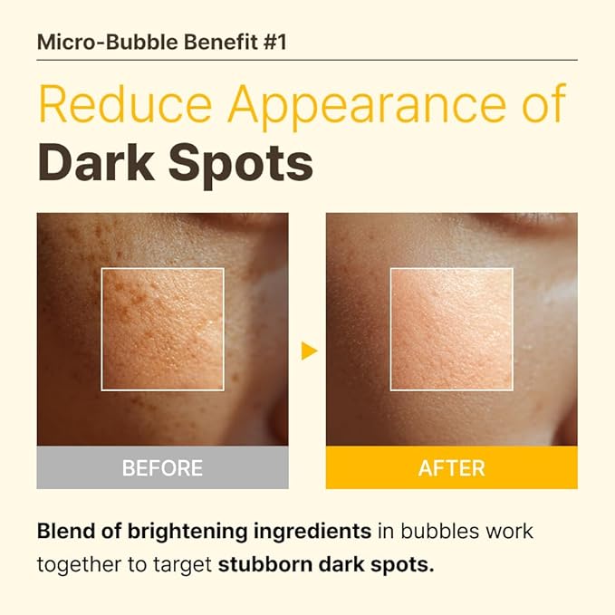 MENOKIN 30 Seconds Quick Bubble Mask [BRIGHT] - [Vitamin C] [Glutathione & Niacinamide] in Micro-bubbles for Dark Spots, Uneven Skin Tone, Korean Skin Care Essential, 70 Uses, 3.21 fl.oz-Velvo Beauty