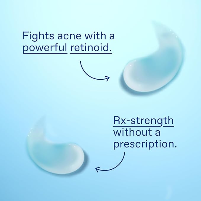 Differin Acne Treatment Gel, 180 Day Supply, Retinoid Treatment for Face with 0.1% Adapalene, Gentle Skin Care for Acne Prone Sensitive Skin, 45g Tube, Pack of 2 (Packaging May Vary)-Velvo Beauty