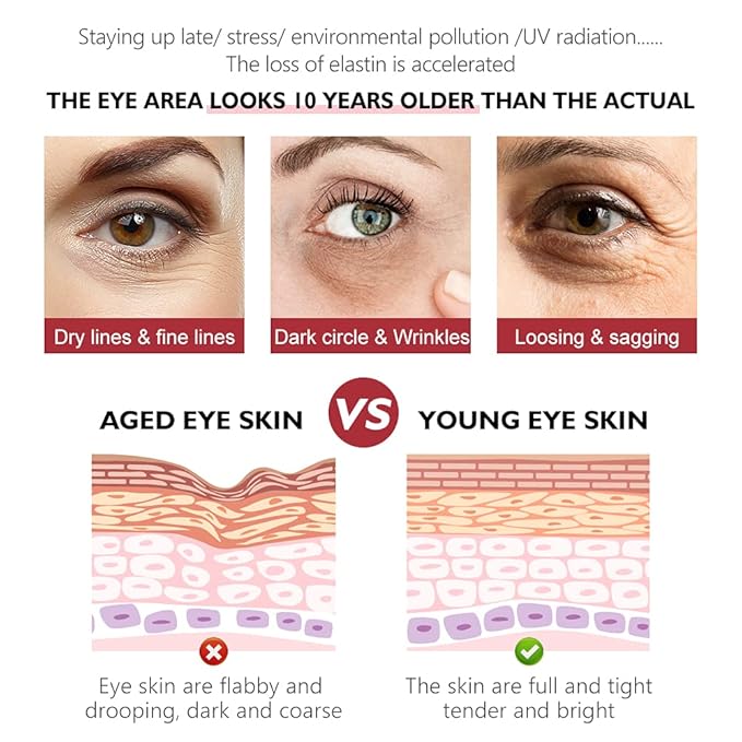 Retinol Eye Cream, Anti-Aging with Vitamin C & Ceramide for Dark Circles, Wrinkles & Fine Lines, Crow’s Feet, 0.7 fl.oz-Velvo Beauty